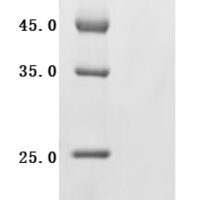 Human Cadherin-5 (CDH5), Partial Recombinant Protein - BioCrest Sci