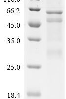 Human Protein lin-28 homolog B (LIN28B) Recombinant Protein, N-His-PDI - BioCrest Sci