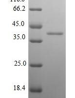 Mouse Kallikrein-14 (Klk14) Recombinant Protein, N-His-SUMO - BioCrest Sci