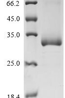 Human Azurocidin (AZU1) Recombinant Protein - BioCrest Sci