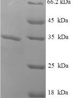 Loxosceles amazonica  Phospholipase D LamSicTox-alphaIC1 Recombinant Protein - BioCrest Sci