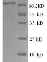 Human Tyrosine-protein kinase BTK (BTK) Recombinant Protein, N-His - BioCrest Sci