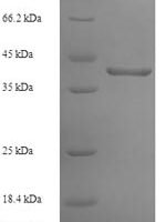 Human Ribonuclease P protein subunit p29 (POP4) Recombinant Protein - BioCrest Sci