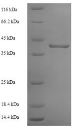 Human Ribonuclease P protein subunit p29 (POP4) Recombinant Protein, Homo sapiens (Human), E.coli, N-terminal 6xHis-SUMO-tagged, 41.4 kDa, purity >≥ 90% as determined by SDS-PAGE.