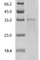 Human BTB/POZ domain-containing protein KCTD21 (KCTD21) Recombinant Protein, C-His - BioCrest Sci