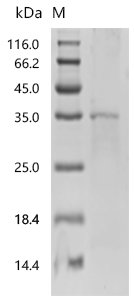 Human BTB/POZ domain-containing protein KCTD21 (KCTD21) Recombinant Protein, C-His, Homo sapiens (Human), E.coli, C-terminal 6xHis-tagged, 36.6 kDa, purity >≥ 85% as determined by SDS-PAGE.