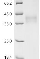 Mouse CD276 antigen (Cd276), partial Recombinant Protein - BioCrest Sci