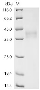 Mouse CD276 antigen (Cd276), partial Recombinant Protein, Mus musculus (Mouse), Mammalian cell, C-terminal 10xHis-tagged, 27.6 kDa, purity >≥ 95% as determined by SDS-PAGE.