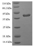 Human Glutathione peroxidase 1 (GPX1) (U49S) Recombinant Protein - BioCrest Sci