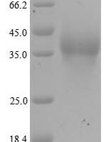 Human E3 SUMO-protein ligase RanBP2 (RANBP2), partial Recombinant Protein, N-His - BioCrest Sci