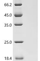 Bovine Insulin-like growth factor 2 (IGF2) Recombinant Protein, N-His - BioCrest Sci