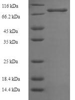 Human E3 ubiquitin-protein ligase XIAP (XIAP) Recombinant Protein, N-His-SUMO - BioCrest Sci