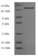 Human E3 ubiquitin-protein ligase XIAP (XIAP) Recombinant Protein, N-His-SUMO, Homo sapiens (Human), E.coli, N-terminal 6xHis-SUMO-tagged, 72.7 kDa, purity >≥ 90% as determined by SDS-PAGE.