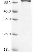 Human parechovirus 1 Genome polyprotein, partial,Biotinylated Recombinant Protein - BioCrest Sci