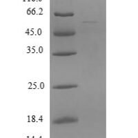 Human Zinc finger and SCAN domain-containing protein 21 (ZSCAN21), partial Recombinant Protein - BioCrest Sci