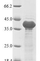 Epstein-Barr virus Latent membrane protein 1 (LMP1), partial Recombinant Protein, N-10His/C-Myc, aa 185–371 - BioCrest Sci