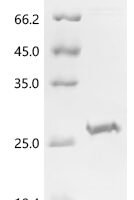 Human Enamelin (ENAM), partial Recombinant Protein, C-His, aa 1043–1142, E.coli - BioCrest Sci