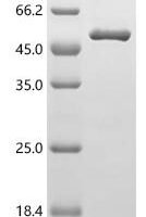 Human Medium-chain specific acyl-CoA dehydrogenase, mitochondrial (ACADM) Recombinant Protein - BioCrest Sci