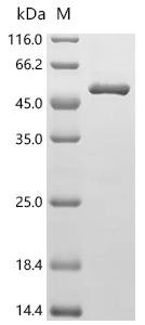 Human Medium-chain specific acyl-CoA dehydrogenase, mitochondrial (ACADM) Recombinant Protein, Homo sapiens (Human), E.coli, C-terminal 6xHis-tagged, 50.6 kDa, purity >≥ 90% as determined by SDS-PAGE.