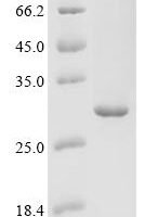 Human C-type lectin domain family 7 member A (CLEC7A), partial Recombinant Protein - BioCrest Sci