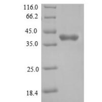 Mouse Tyrosine-protein kinase JAK1 (Jak1), partial Recombinant Protein - BioCrest Sci