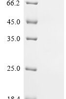 Human DNA polymerase theta (POLQ), partial Recombinant Protein, C-His-SUMO - BioCrest Sci