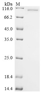 Human DNA polymerase theta (POLQ), partial Recombinant Protein, C-His-SUMO, Homo sapiens (Human), E.coli, C-terminal 6xHis-SUMO-tagged, 98.7 kDa, purity >≥ 85% as determined by SDS-PAGE.