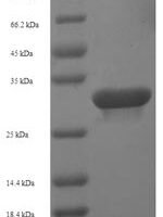 Human Guanosine-3',5'-bis (diphosphate) 3'-pyrophosphohydrolase MESH1 (HDDC3) Recombinant Protein - BioCrest Sci