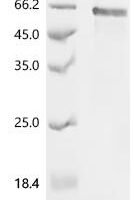 Human Mucin-13 (MUC13), partial Recombinant Protein, N-10His - BioCrest Sci