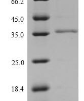 Mouse Lymphocyte antigen 6C1 (Ly6c1) Recombinant Protein - BioCrest Sci
