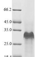 Mouse Small proline-rich protein 2B (Sprr2b) Recombinant Protein, N-10His/C-Myc, aa 1–98, E.coli - BioCrest Sci
