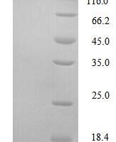 Mouse Glucagon receptor (Gcgr), partial Recombinant Protein, N-His - BioCrest Sci