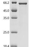 Human Non-receptor tyrosine-protein kinase TYK2 (TYK2), partial Recombinant Protein, C-His - BioCrest Sci