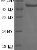 Saccharomyces cerevisiae Alpha-galactosidase 1 (MEL1) Recombinant Protein, N-His - BioCrest Sci