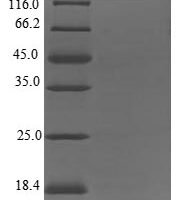 Human Leukocyte-specific transcript 1 protein (LST1) Recombinant Protein - BioCrest Sci