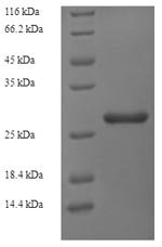 Rat Ribosyldihydronicotinamide dehydrogenase (Nqo2) Recombinant Protein, Rattus norvegicus (Rat), Yeast, N-terminal 6xHis-tagged, 28.3 kDa, purity >≥ 90% as determined by SDS-PAGE.