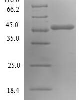 Human GTP-binding protein SAR1a (SAR1A) Recombinant Protein - BioCrest Sci