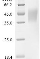 Human High affinity immunoglobulin epsilon receptor subunit alpha (FCER1A), partial Recombinant Protein, C-10His - BioCrest Sci