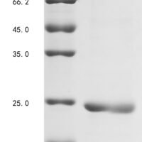 Medicago truncatula LysM domain protein (MTR_4g091020) Recombinant Protein - BioCrest Sci