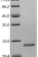 Mouse Indian hedgehog protein (Ihh), partial Recombinant Protein, C-10His - BioCrest Sci
