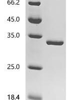 Escherichia coli O157:H7 Hydrogenase 3 maturation protease (hycI) Recombinant Protein, N-His-SUMO - BioCrest Sci