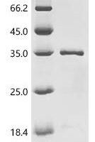Human Transcription factor p65 (RELA), partial Recombinant Protein, C-His - BioCrest Sci