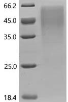 Rat V-set domain-containing T-cell activation inhibitor 1 (Vtcn1) Recombinant Protein - BioCrest Sci