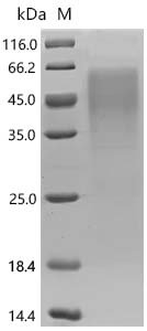 Rat V-set domain-containing T-cell activation inhibitor 1 (Vtcn1) Recombinant Protein, Rattus norvegicus (Rat), Mammalian cell, C-terminal 10xHis-tagged, 27.0 kDa, purity >≥ 95% as determined by SDS-PAGE.
