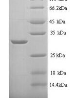 Rat Carbonic anhydrase 1 (Ca1) Recombinant Protein, N-His, aa 2–261, Yeast - BioCrest Sci