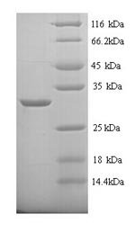 Rat Carbonic anhydrase 1 (Ca1) Recombinant Protein, N-His, aa 2–261, Yeast, Rattus norvegicus (Rat), Yeast, N-terminal 6xHis-tagged, 30.2 kDa, purity >≥ 90% as determined by SDS-PAGE.