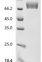 Human Natural cytotoxicity triggering receptor 3 ligand 1 (NCR3LG1), partial Recombinant Protein - BioCrest Sci