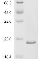 Human RNA guanine-N7 methyltransferase activating subunit (RAMAC) Recombinant Protein - BioCrest Sci