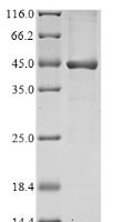 Burkholderia pseudomallei UDP-3-O-acylglucosamine N-acyltransferase (lpxD) Recombinant Protein - BioCrest Sci