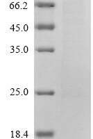Human Myc proto-oncogene protein (MYC),Biotinylated Recombinant Protein - BioCrest Sci